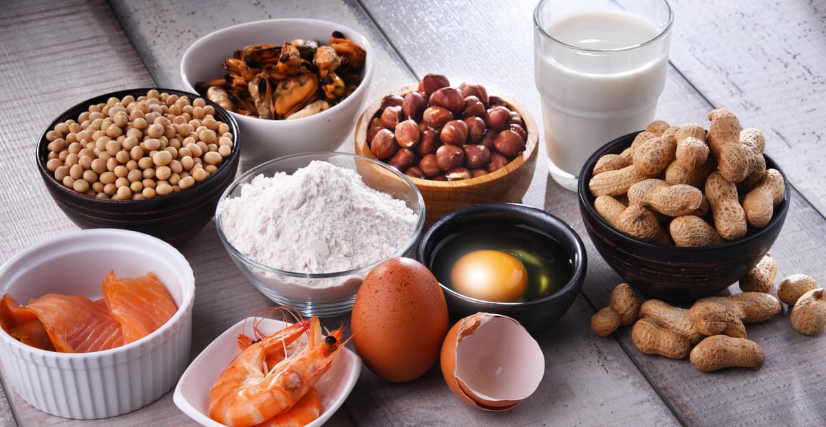 Food allergy testing and management services