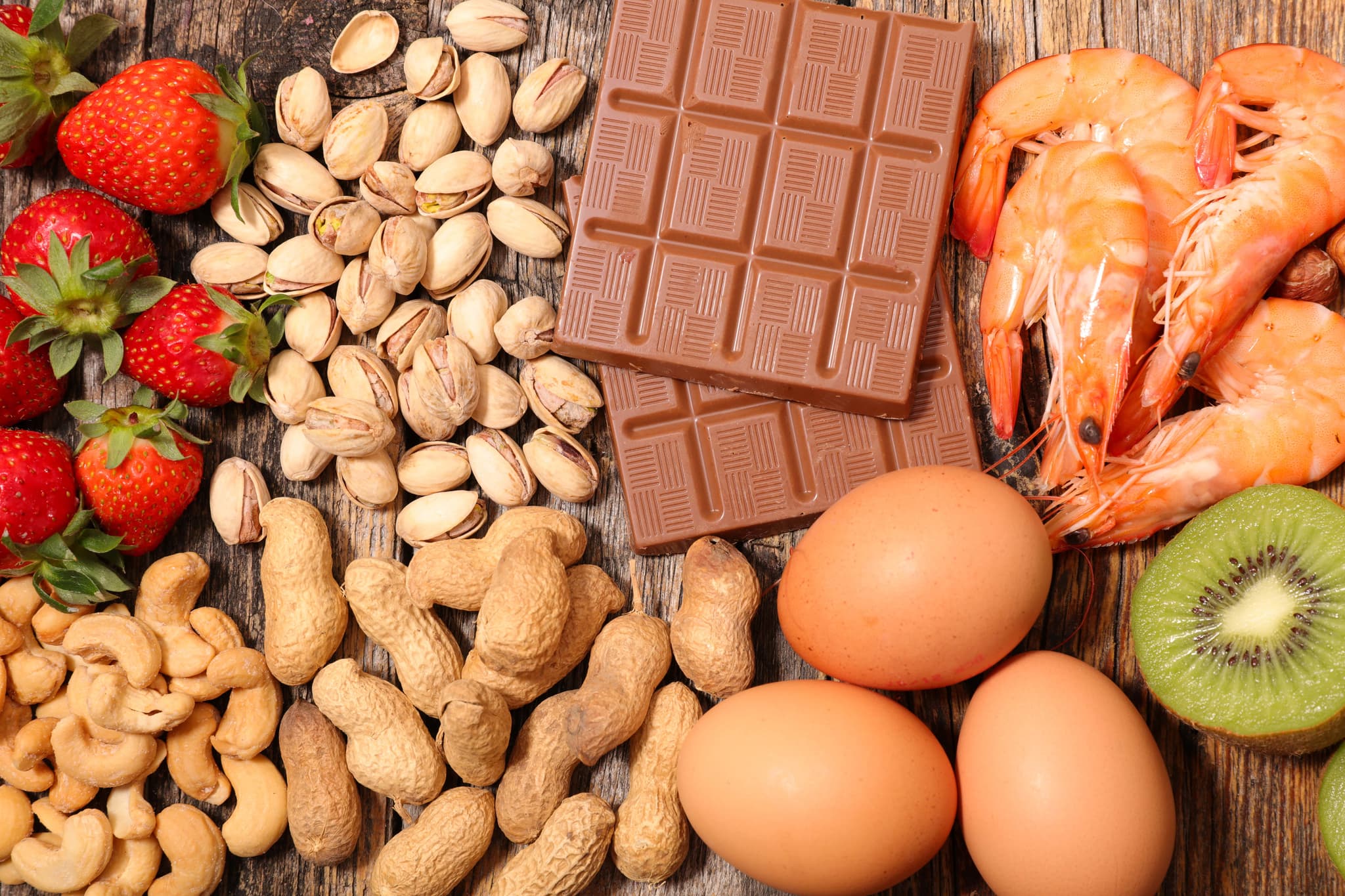 Food allergies display showing dietary restrictions